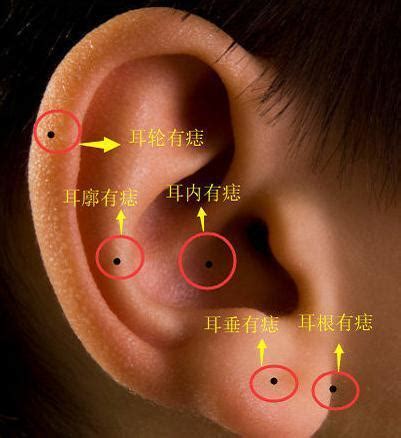 耳痣圖|耳朵长痣的位置图解 耳朵长痣的位置图解有福气